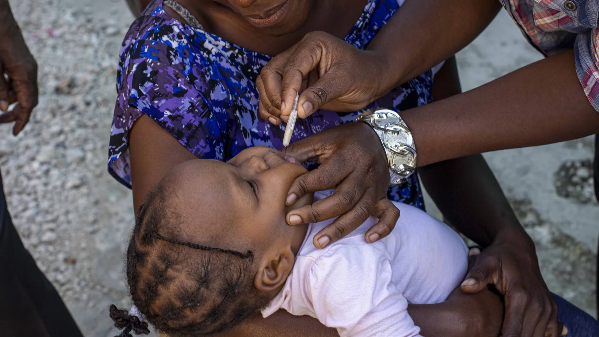 Reasons to have a RNA